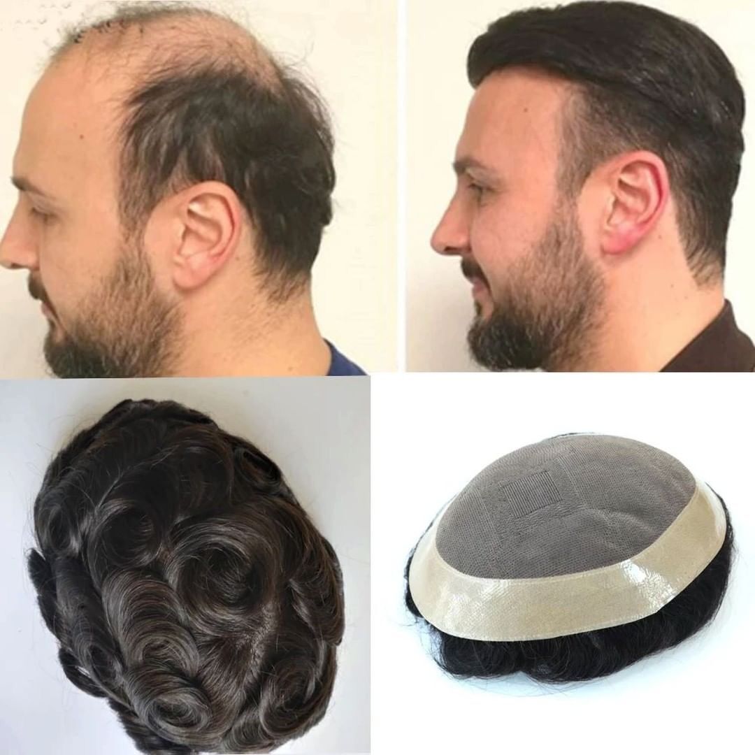 Mono Toupee Systems